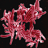 Digitally-colorized scanning electron micrograph of rod-shaped Mycobacterium tuberculosis bacteria  (Photo Credit: NIAID)